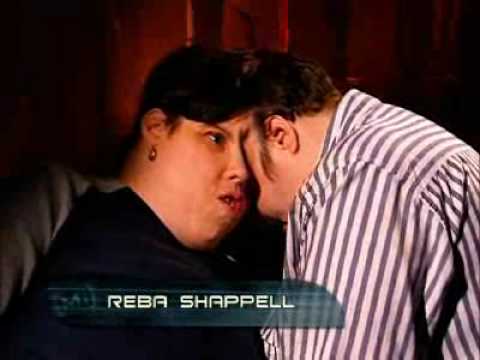 Lori and Reba Schappell - Conjoined Twins